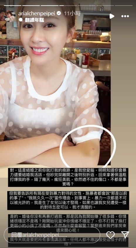 陳佩佩曝光婚前就遭拿鐵暴力的瘀青照。（翻攝自IG arialchenpeipei）
