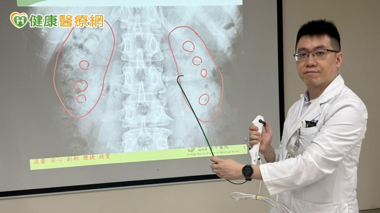 簡維弘醫師示範利用軟式輸尿管鏡從尿道進入腎臟，以雷射碎石後取出體外的手術方式。（健康醫療網提供）