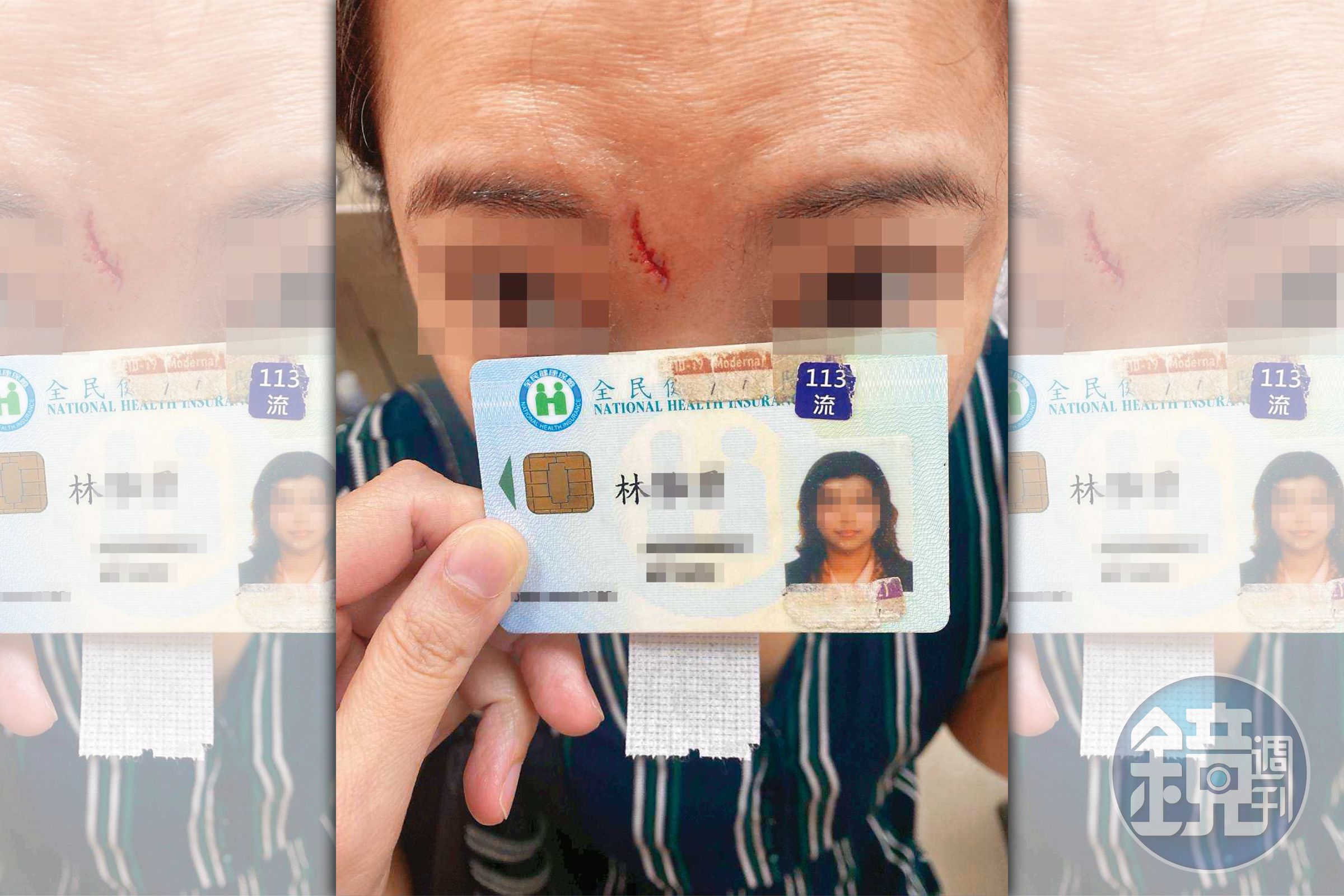 →女律師在浴室2度昏倒、眉心撞上水龍頭,受傷破相。(讀者提供)