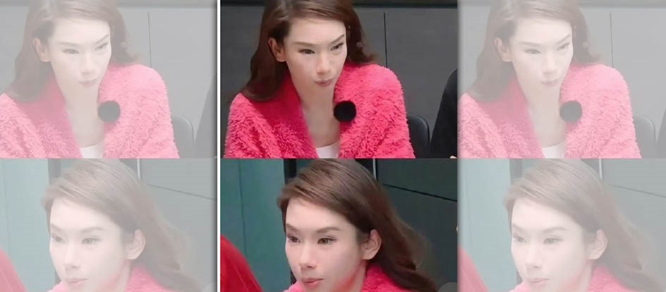 女星戚薇日前在陸綜《妻子的浪漫旅行》中整張臉浮腫。（翻攝自微博）