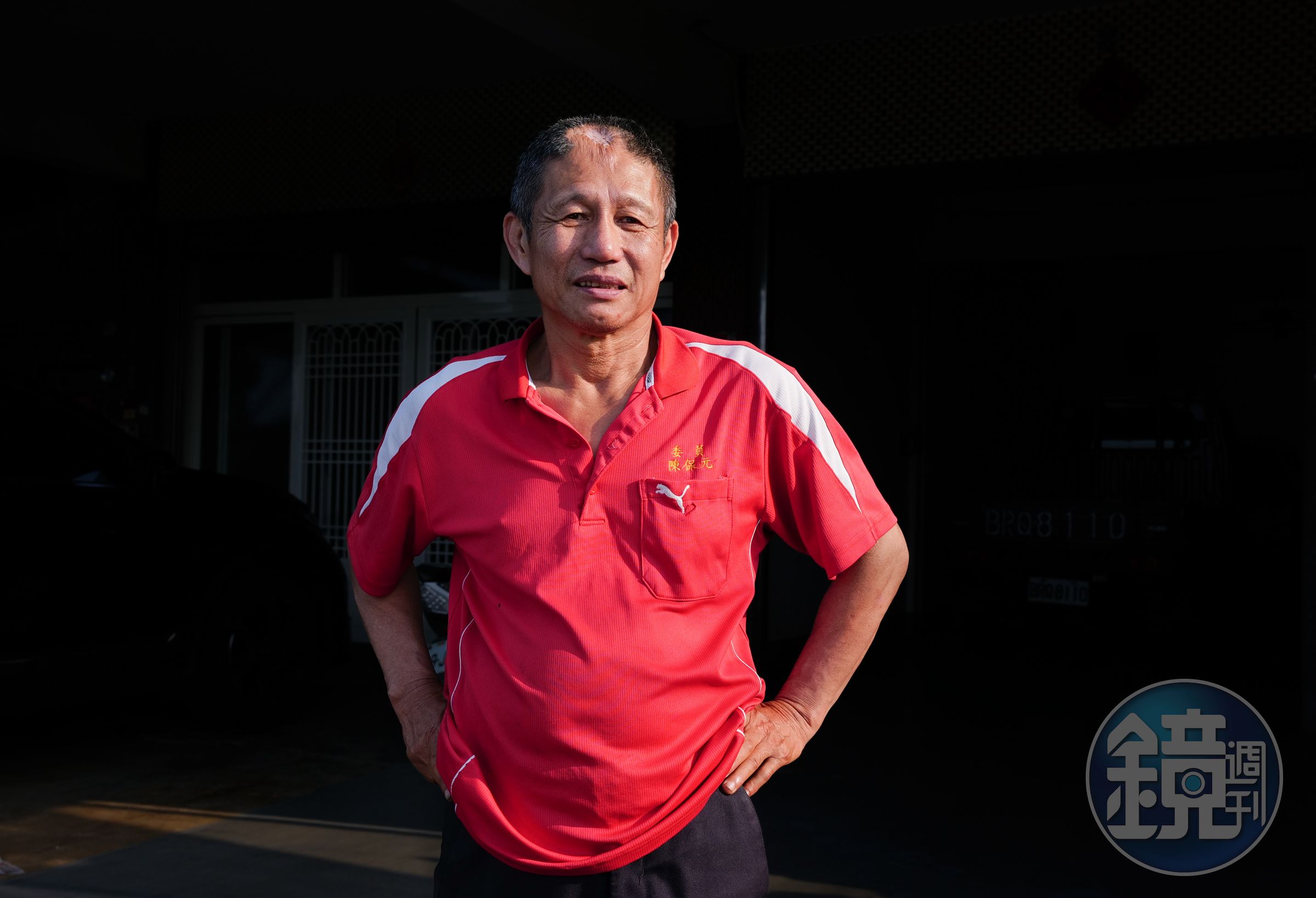 陳保元擔任乩生40年,因為操五寶敲擊,額頭上方凹陷明顯且長不出頭髮。