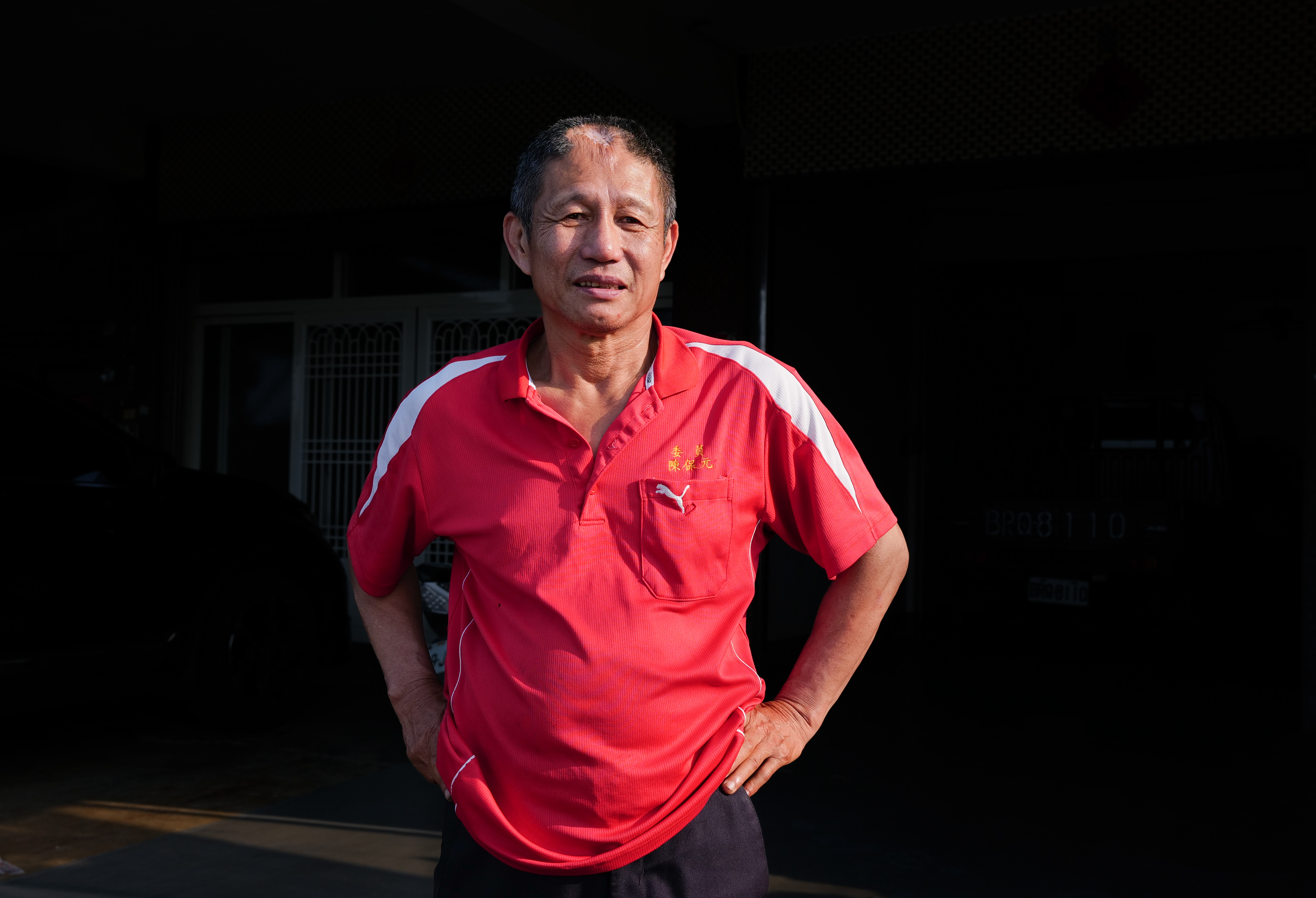 陳保元擔任乩生40年，因為操五寶敲擊，額頭上方凹陷明顯且長不出頭髮。