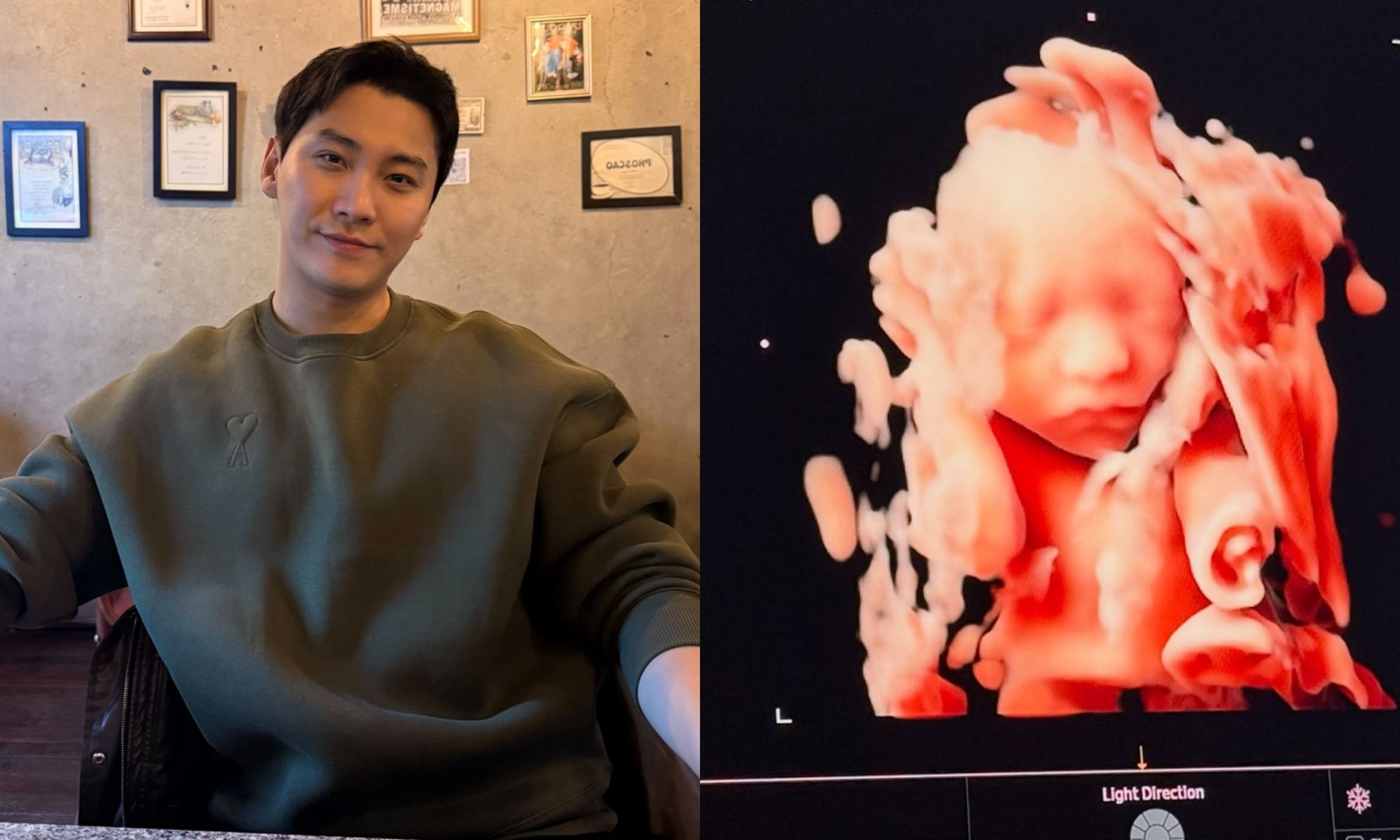 宋承炫公開兒子的胎兒3D立體超音波照,宣布喜訊。(翻攝宋承炫IG)