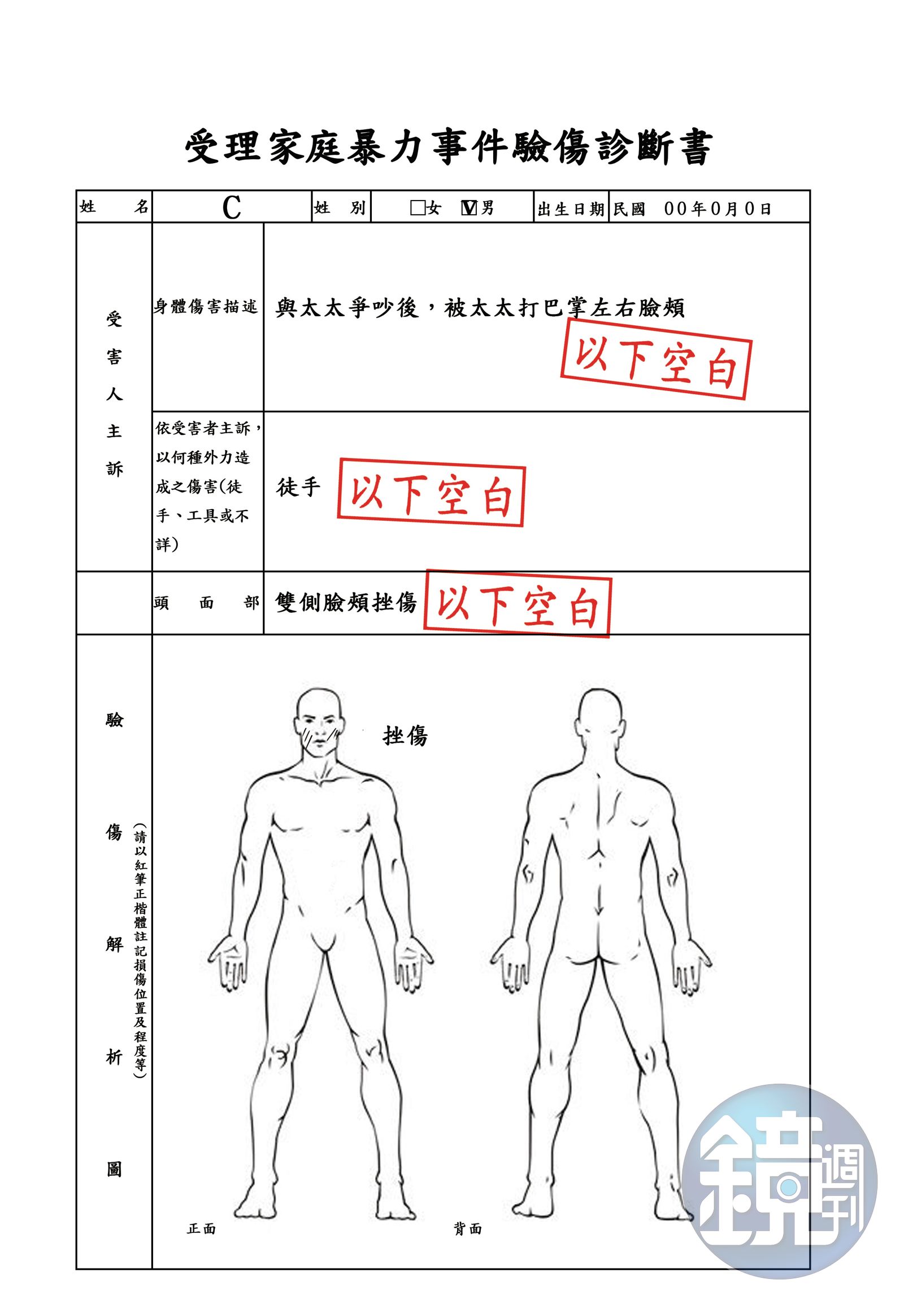 遭妻呼了數次巴掌後，醫院驗傷單清楚寫下雙側臉頰挫傷，成第三勢力要角C聲請保護令的鐵證。（本刊設計畫面）