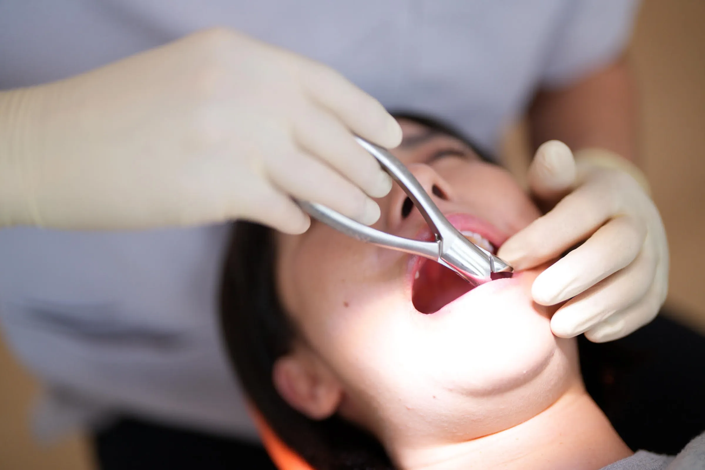 牙醫透露可從患者嘴內是否出現顎部瘀斑,輕鬆判斷對方近期是否頻繁口交。(示意圖,photoAC)