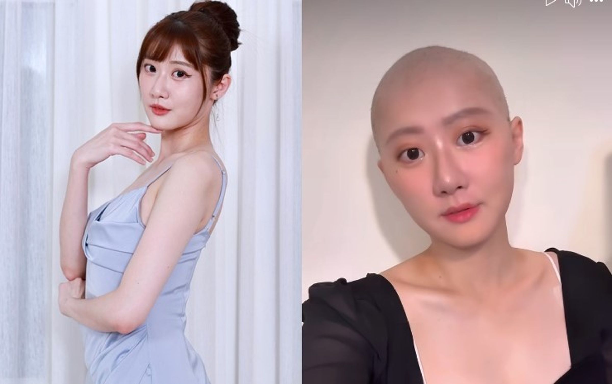 「國光女神」林茉晶罹患亮細胞卵巢癌,化療除了讓她掉髮外,還變胖20公斤。(翻攝自林茉晶臉書)