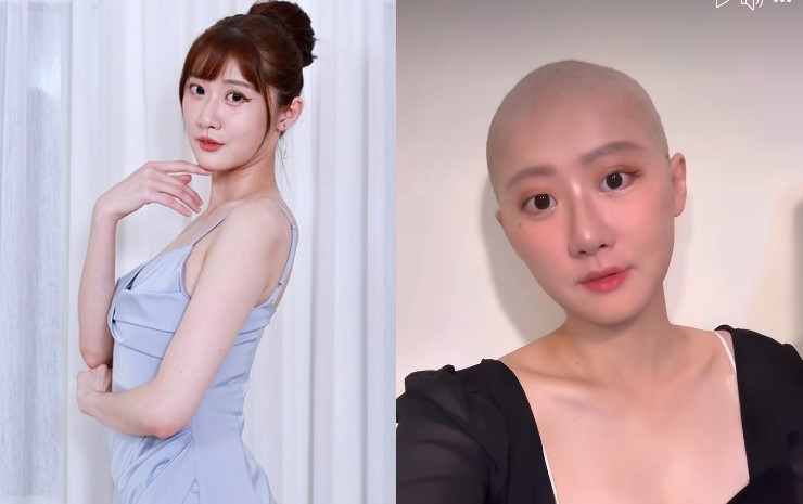 「國光女神」林茉晶罹患亮細胞卵巢癌，化療除了讓她掉髮外，還變胖20公斤。（翻攝自林茉晶臉書）