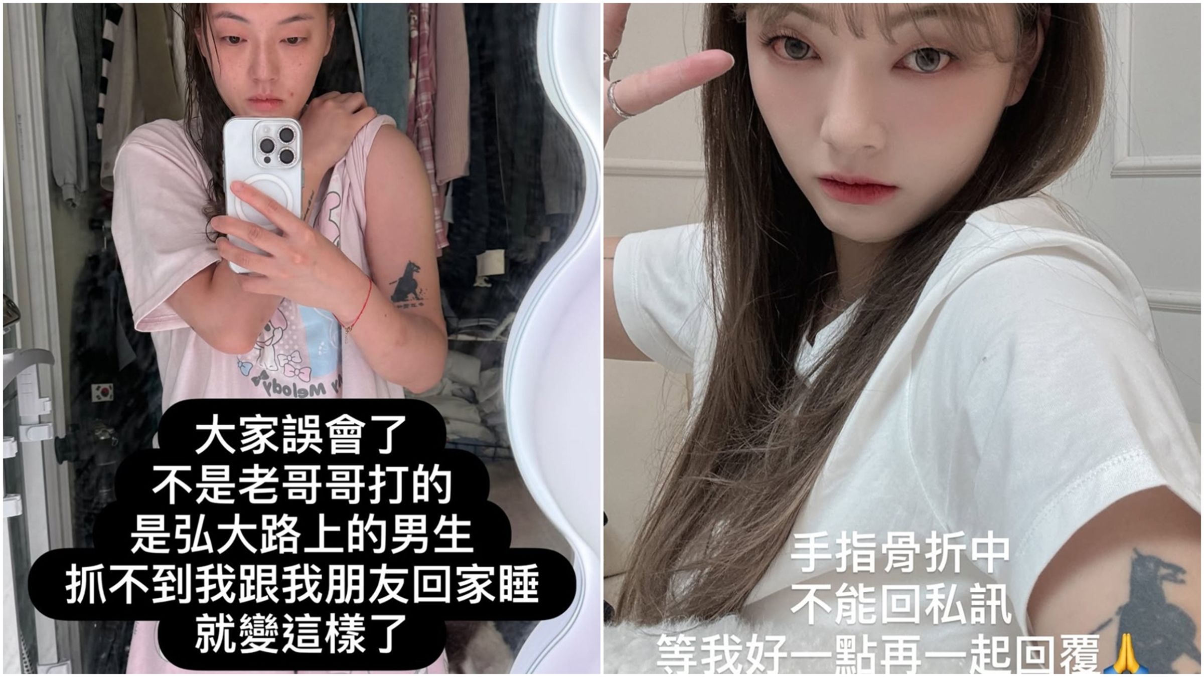 劉力穎替友人澄清,也表示因受傷,等到狀況好一點再一一回應粉絲訊息。(翻攝自Instagram@liying0731)