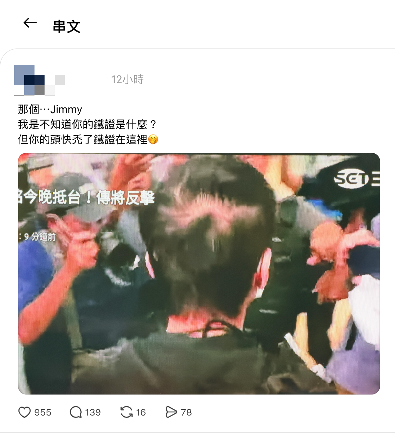 趙建銘禿頭情況，在Threads上引發網友討論。（翻攝Threads）