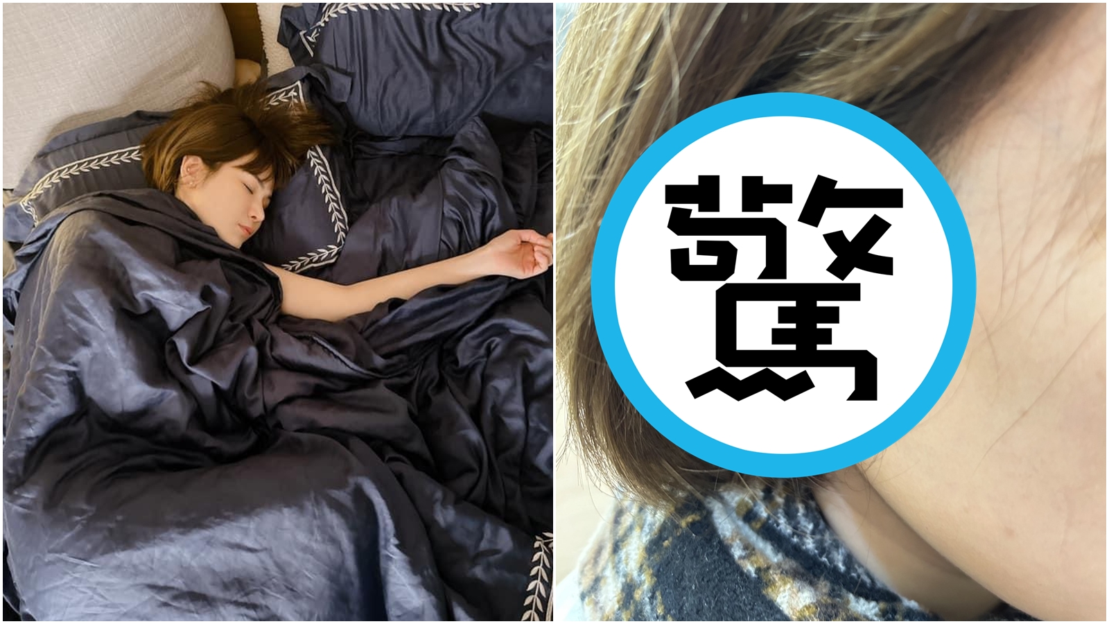 陳沂遭人預謀性犯案，對方還稱自己認錯人。（翻攝自陳沂臉書）