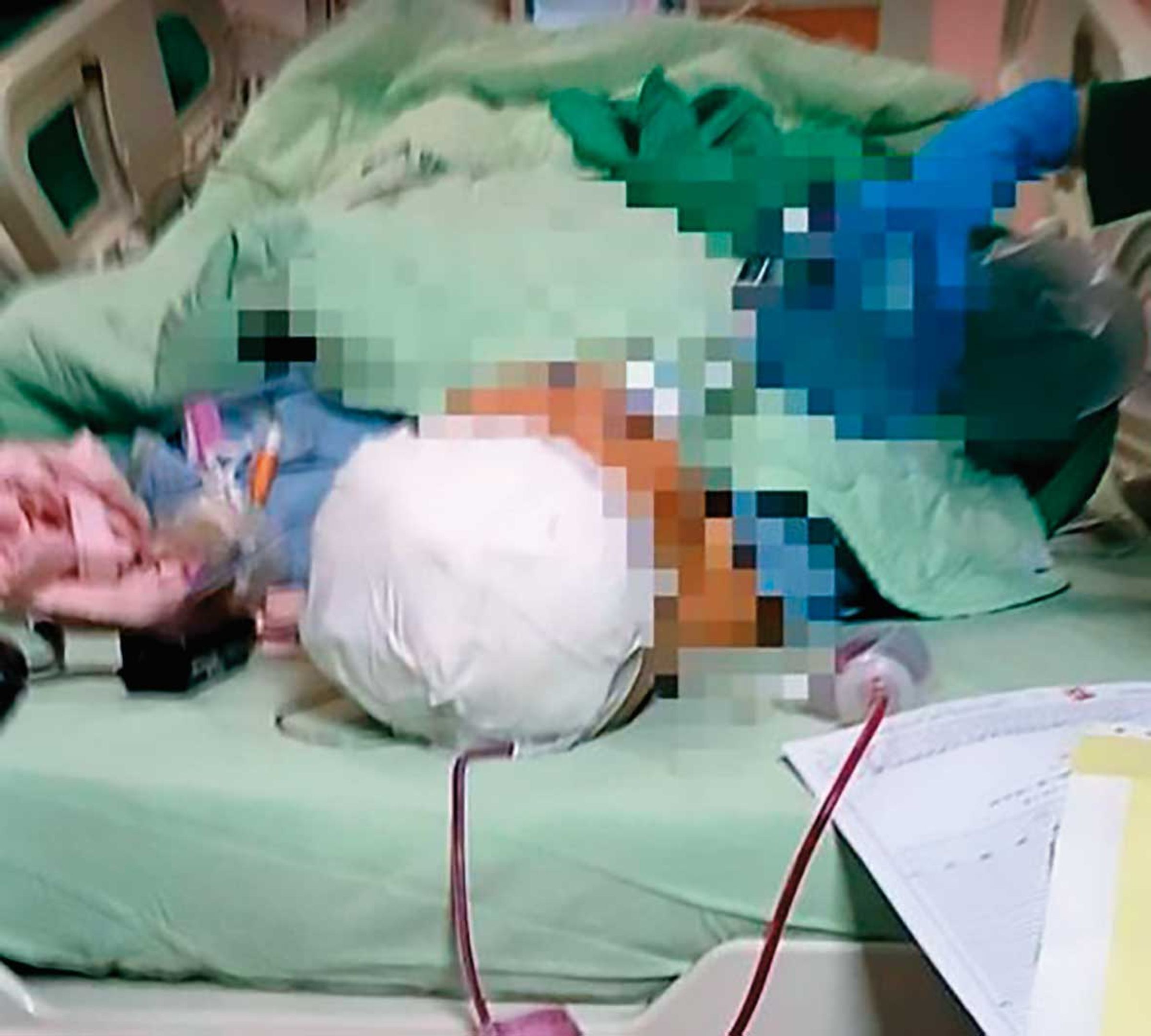 吳妻被送往醫院搶救後，雖經緊急手術保住性命，仍無法恢復意識，只能靠呼吸器維持生命。（翻攝臉書）