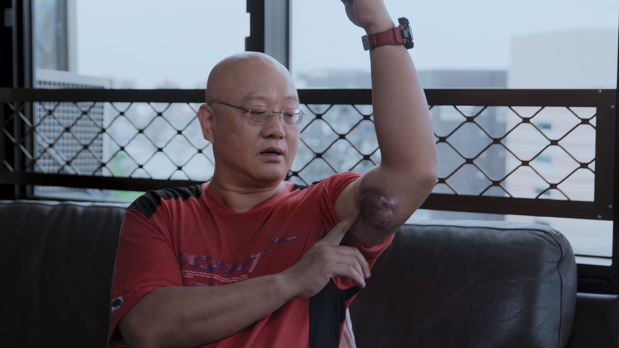 片中罹患骨肉瘤的「Sam哥」在曾寶儀面前展示了超大的腫瘤，曾寶儀形容腫瘤摸起來硬硬，感覺它是個有生命、會呼吸的個體。（双喜提供）