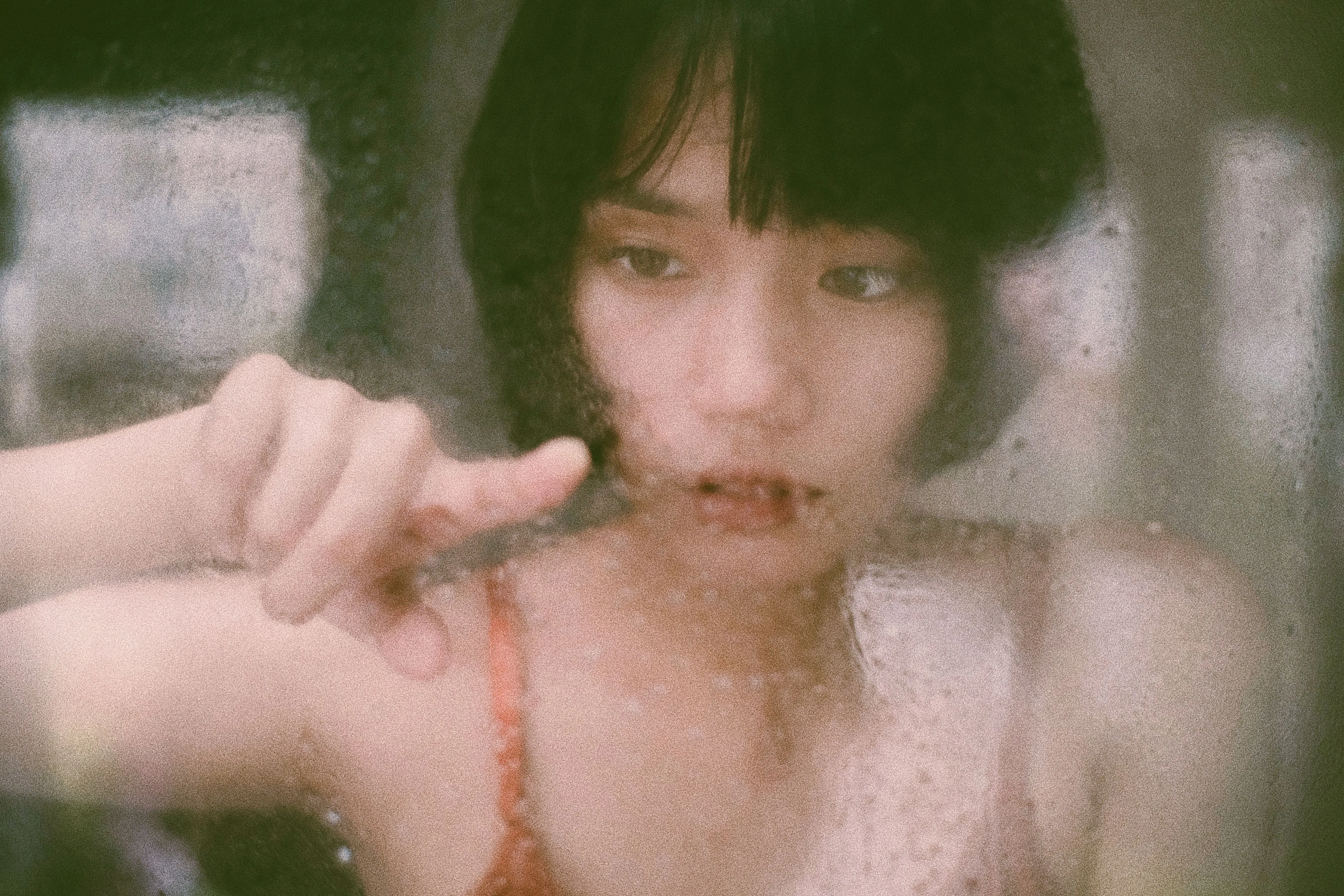 雨一來皮就癢　這種濕疹中醫有招
