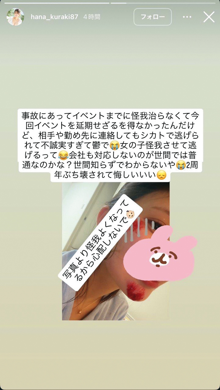 流出的對話截圖中，倉木華曾貼出自己的臉部傷勢，控訴事故後平良翔太避不處理。（翻攝自倉木華IG）