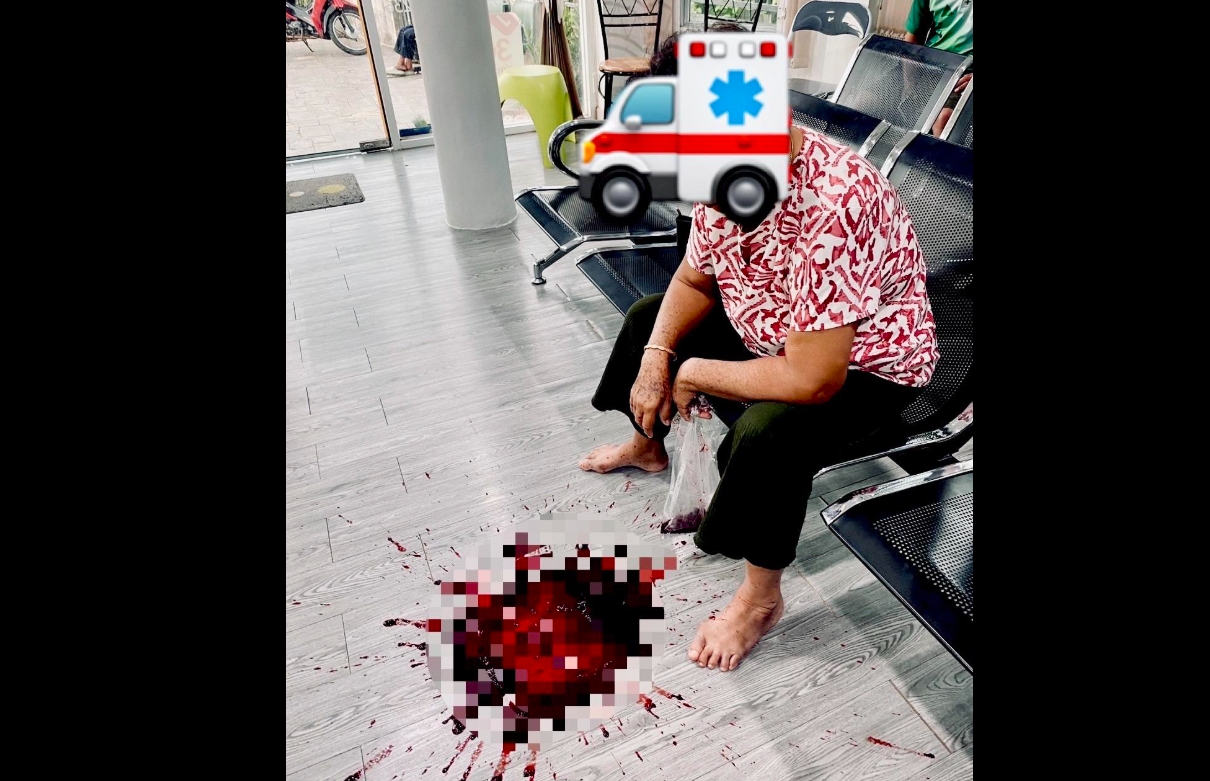 有女患者因連續服用口服及注射非類固醇消炎止痛藥，結果因用藥過量竟當場吐血。（翻攝自臉書@คลินิกเวชกรรมแพทย์คิมหันต์）