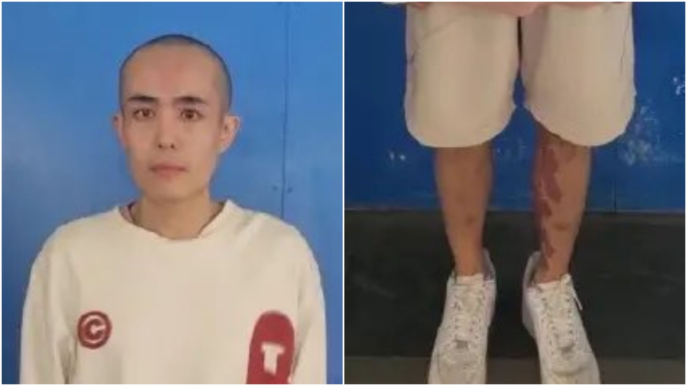 星星一頭黑髮消失，現在被剃光頭。（翻攝X）