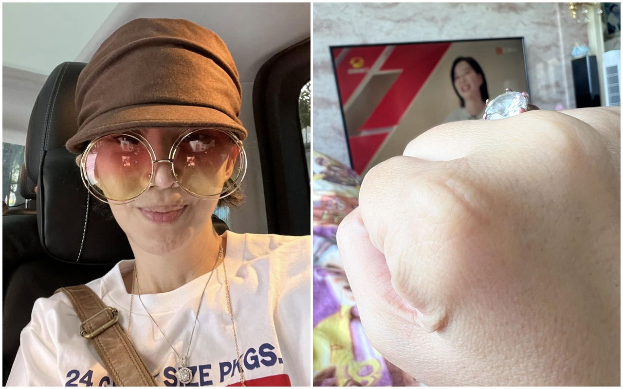 女星李宇柔罹患罕見疾病的兒子日前離世，她今天曬出一枚「鑽戒」，補充提到「以後不論天南地北，他都會跟著我們去了」。（翻攝自李宇柔臉書）