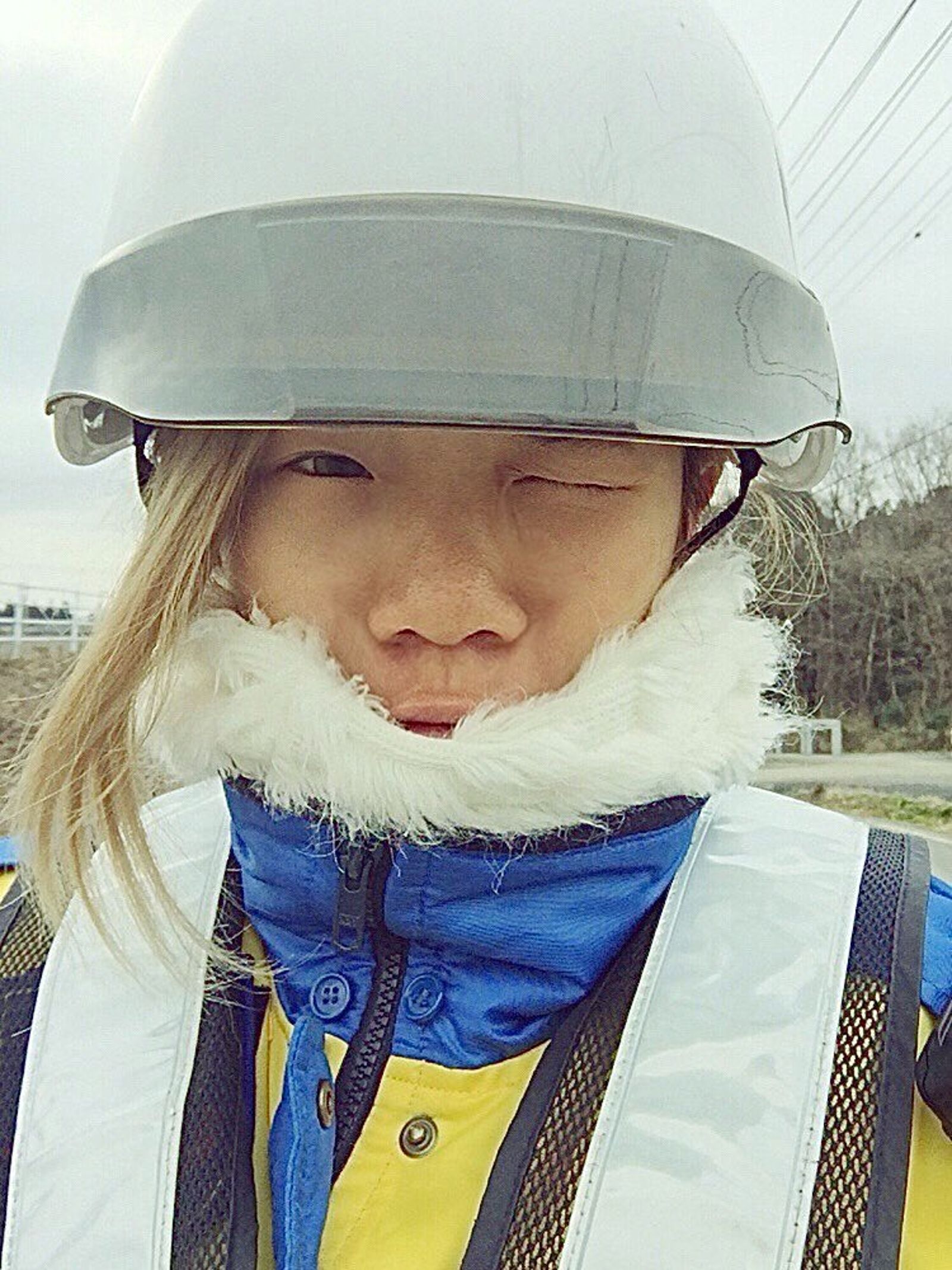 平瀨愛理詳細揭露整形部位與總花費。（翻攝自平瀨愛理Ｘ）