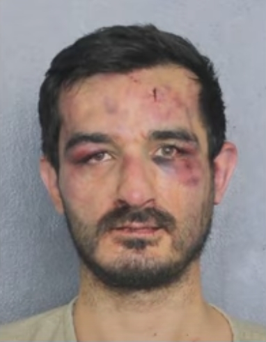 闖入民宅的醉漢被MMA拳手修理到鼻青臉腫，最後拍下狼狽囚犯照。（翻攝自youtube@CBS 12 News - WPEC）