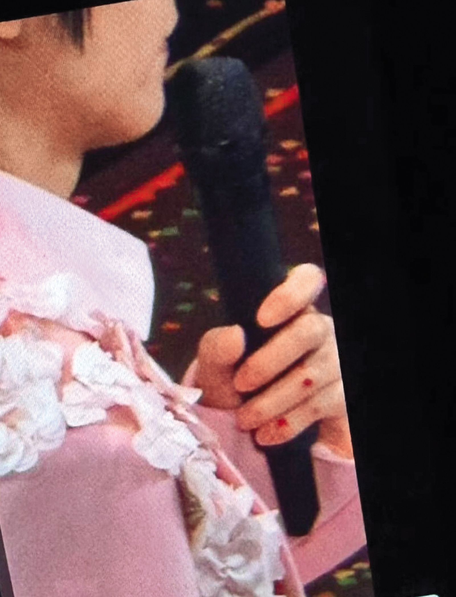 阿信在《F✦FOREVER 恆星之城》上海演唱會不慎跌落台，手上還有滲血傷口（圖），嚇壞眾人。 （翻攝自小紅書）