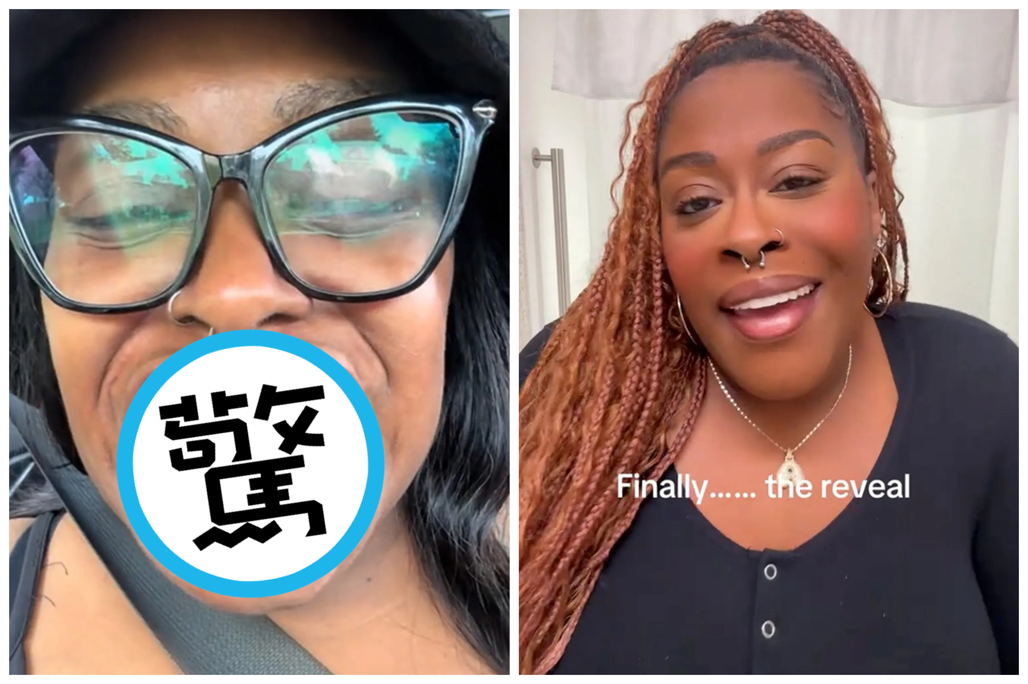 阿雅娜海德斯佩斯因為嚴重牙周病掉光牙齒(左圖),接受植牙手術後,重拾笑容(右圖)。(翻攝2infinityndamom TikTok)