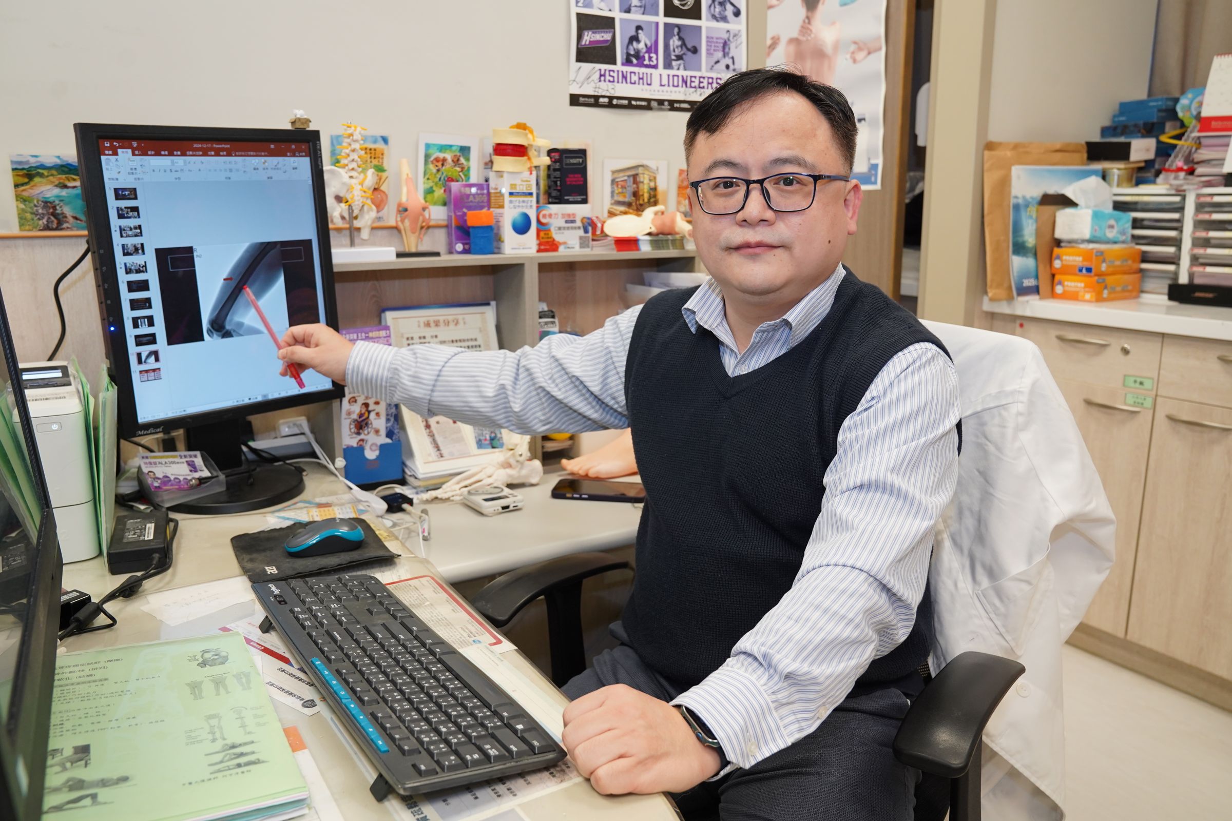 復健科何宇淳醫師指出，「骨化性肌炎」若影響到關節活動，需考慮手術治療。（中國醫藥大學新竹附設醫院提供）
