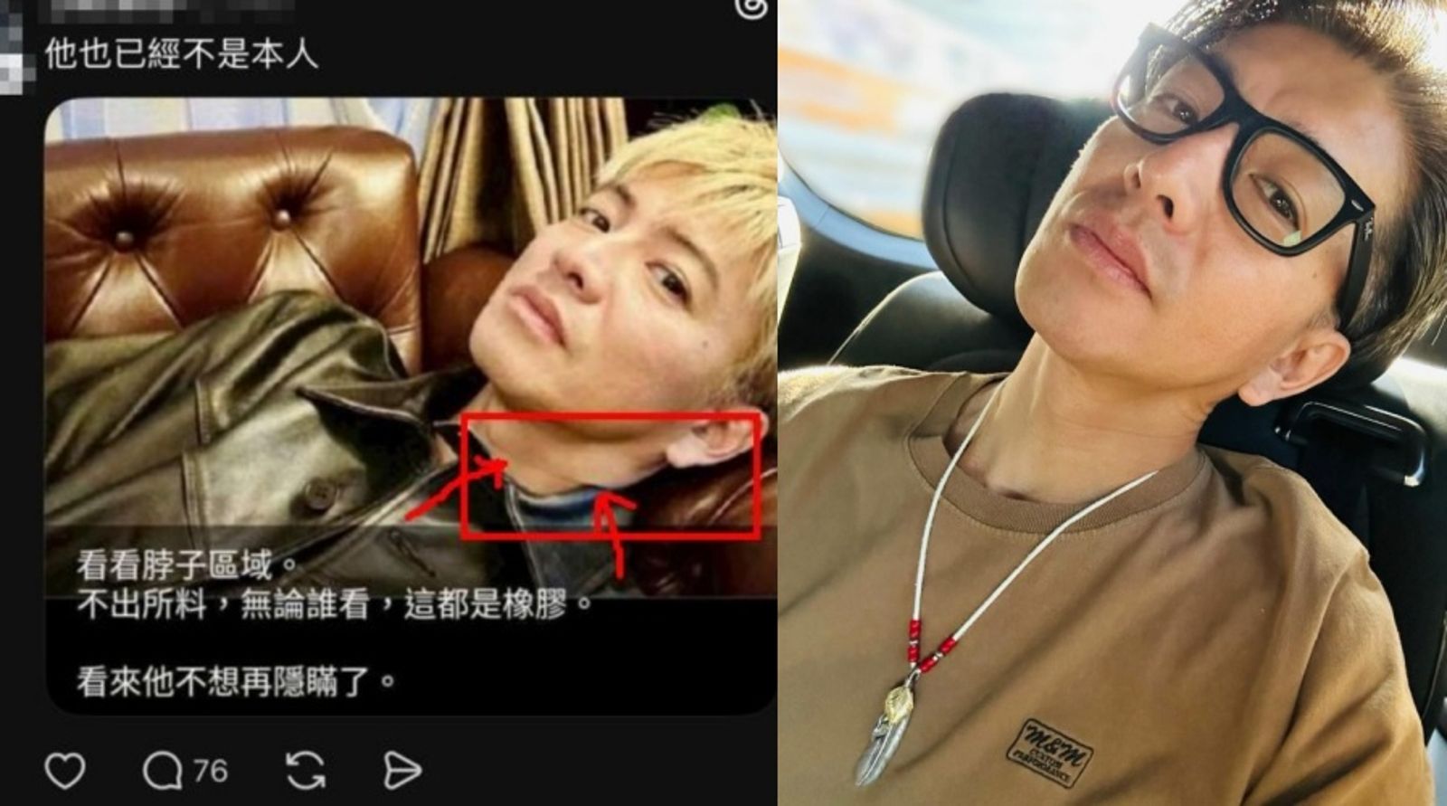 木村拓哉被疑「戴人皮頭套」？代言華為後外貌惹議　粉絲：和以前長得不一樣