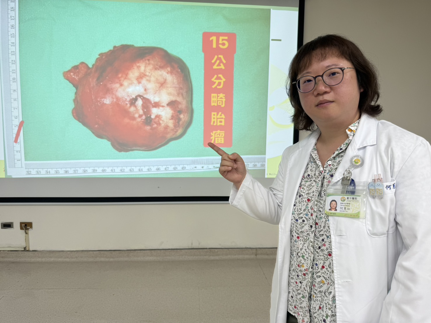 驚見15公分巨大腫瘤和心臟一樣大！　醫師：母體胚胎發育的畸胎瘤