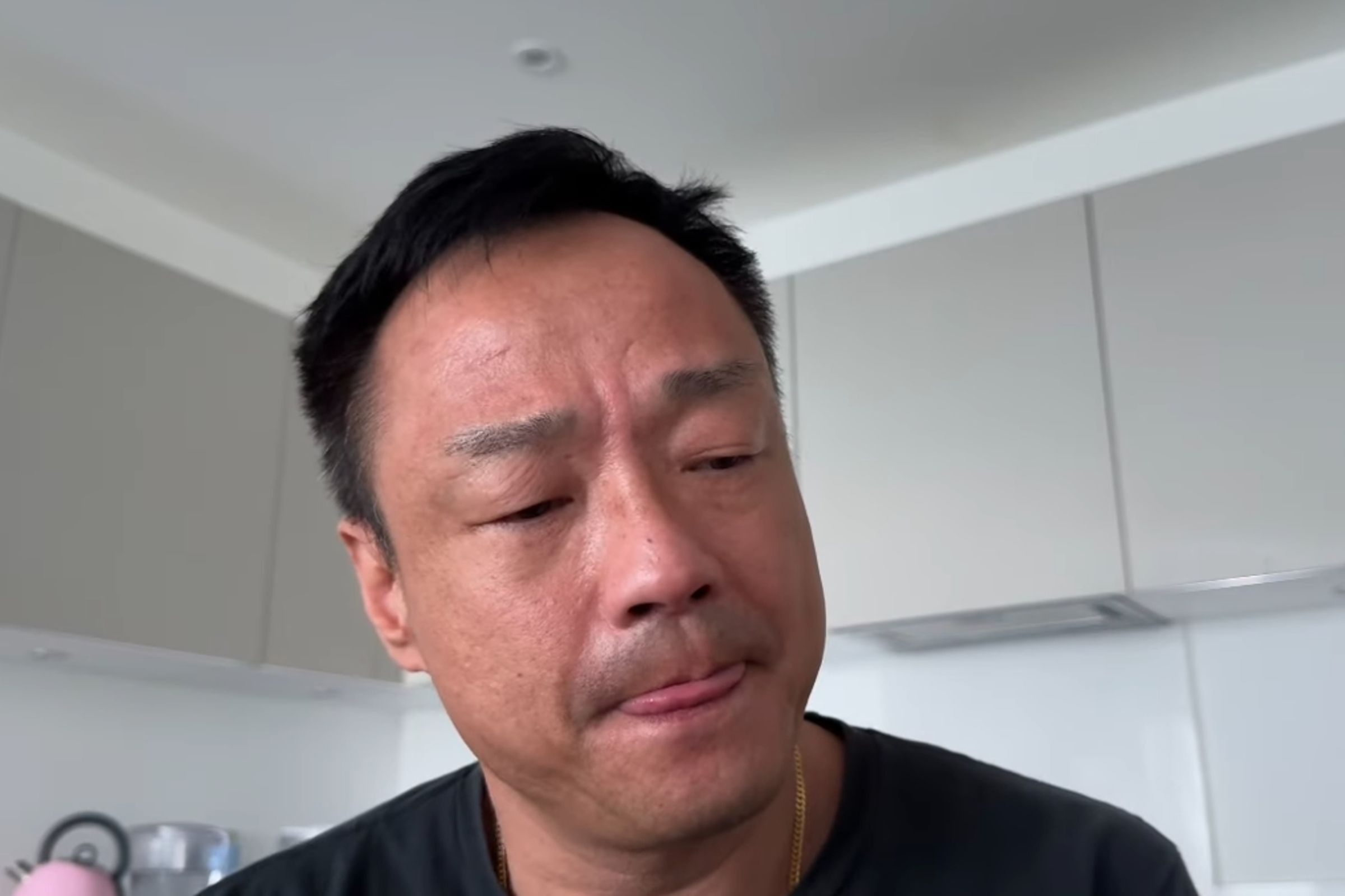 香港男星王喜詳述2次在台疑似遭性侵的經歷,並公開自己身上多處瘀傷與健康惡化情況。(翻攝自喜來大DD YT)