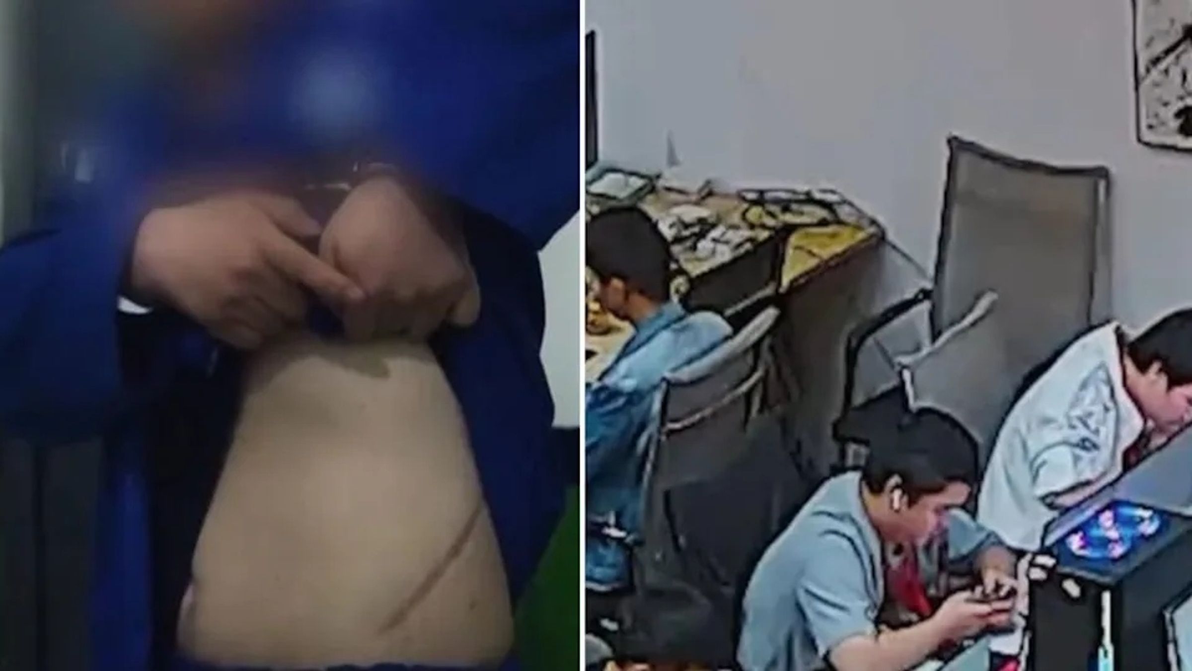 東南亞緬甸詐騙園區有逃離的受害者撩起衣服秀出30公分長的傷疤曝「業績太差被逼割腎抵債」。(翻攝自央視)
