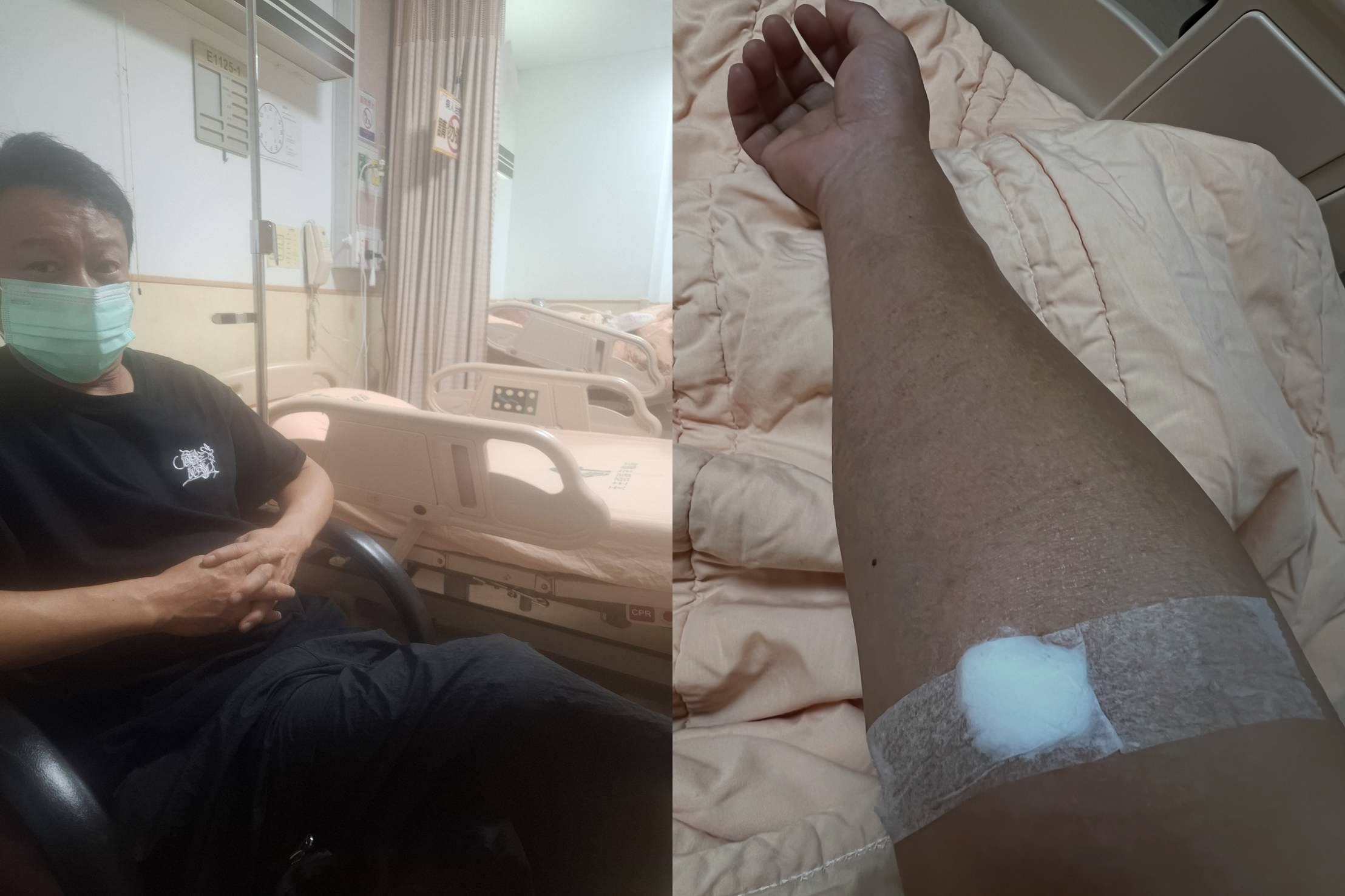 金馬影帝李康生今日緊急接受心導管手術,在心臟血管放了支架及氣球,治療其心血管疾病。(蔡明亮/李康生臉書)