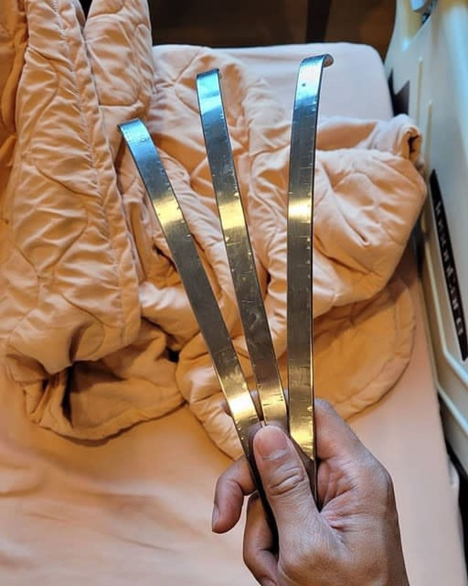 裝在體內的支架曾讓婁峻碩痛不欲生。（翻攝自Threads）