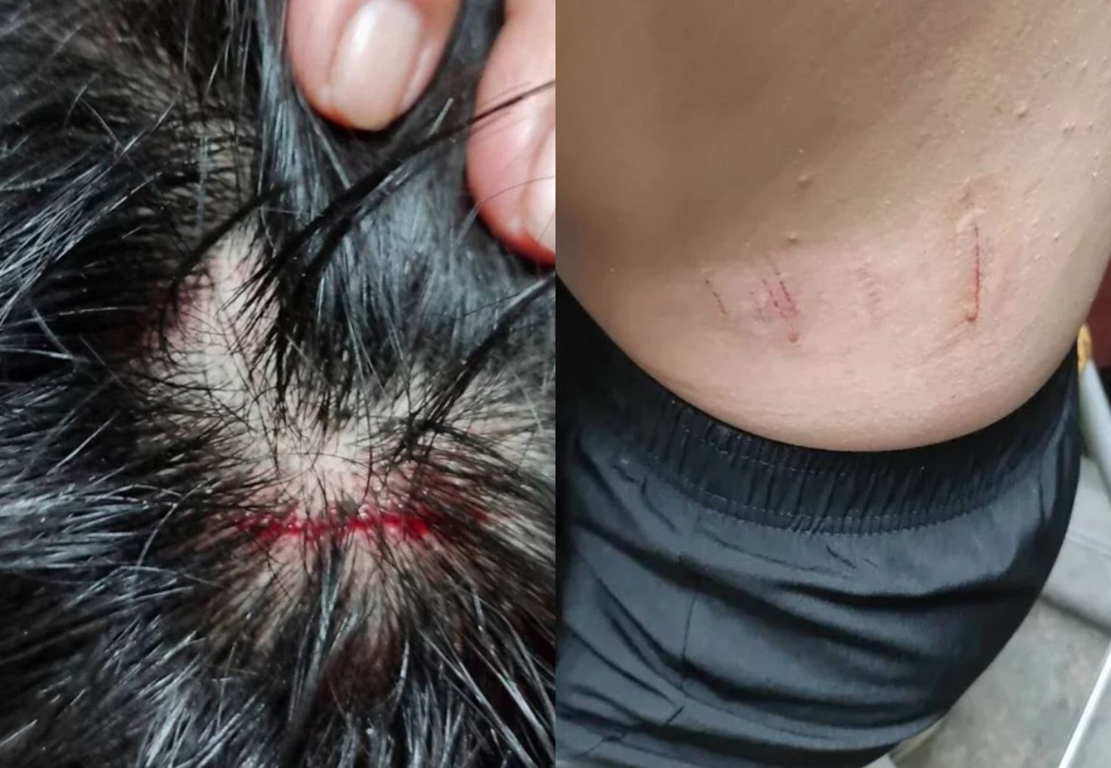 彰化浪犬又追人!13歲男童遭10多隻狗狂追 摔車後狂奔800公尺逃命