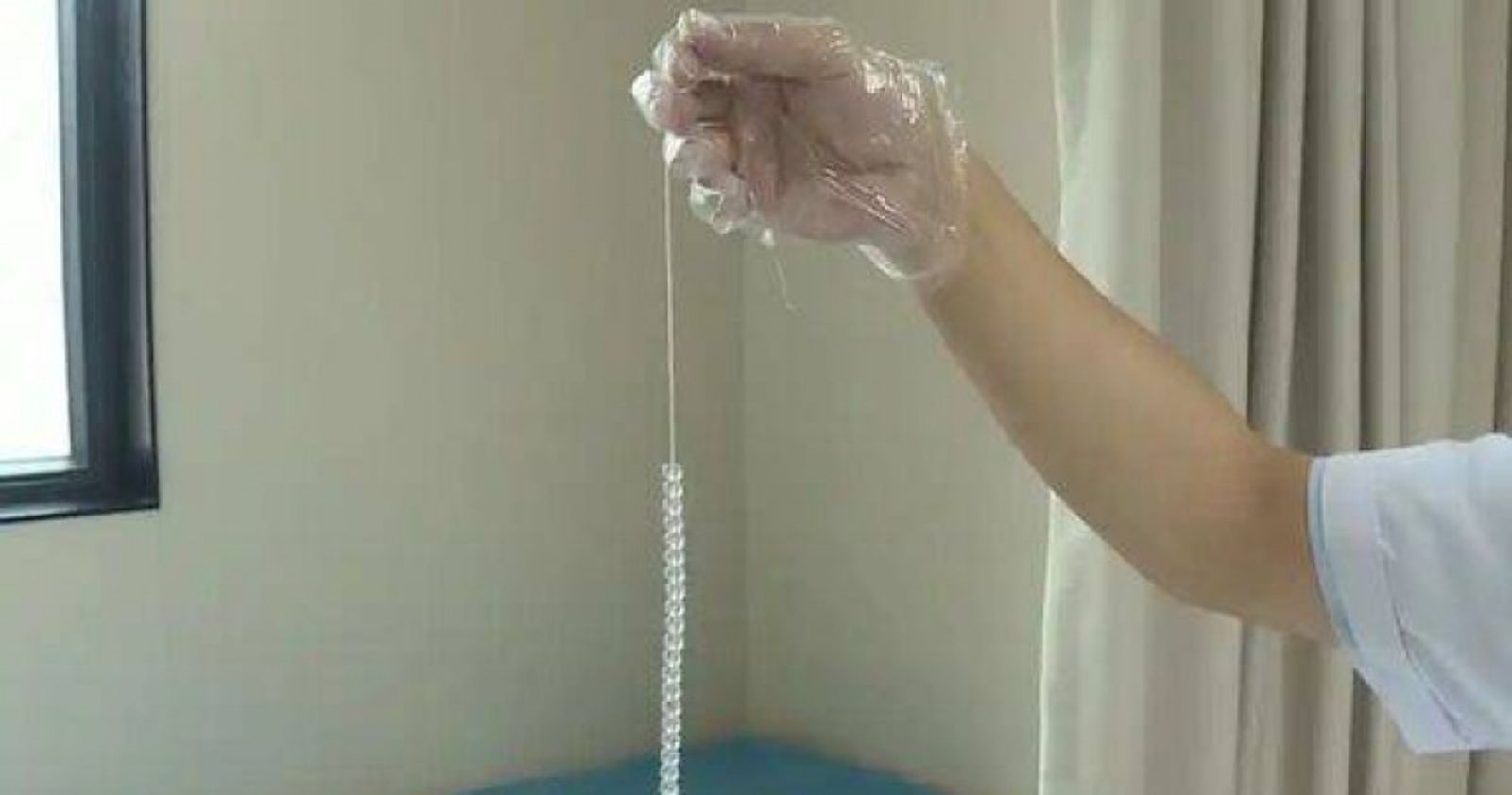 26歲男好奇「尿道塞24顆珠子」!18公分珠鍊打死結卡膀胱 醫動刀驚揭恐怖下場