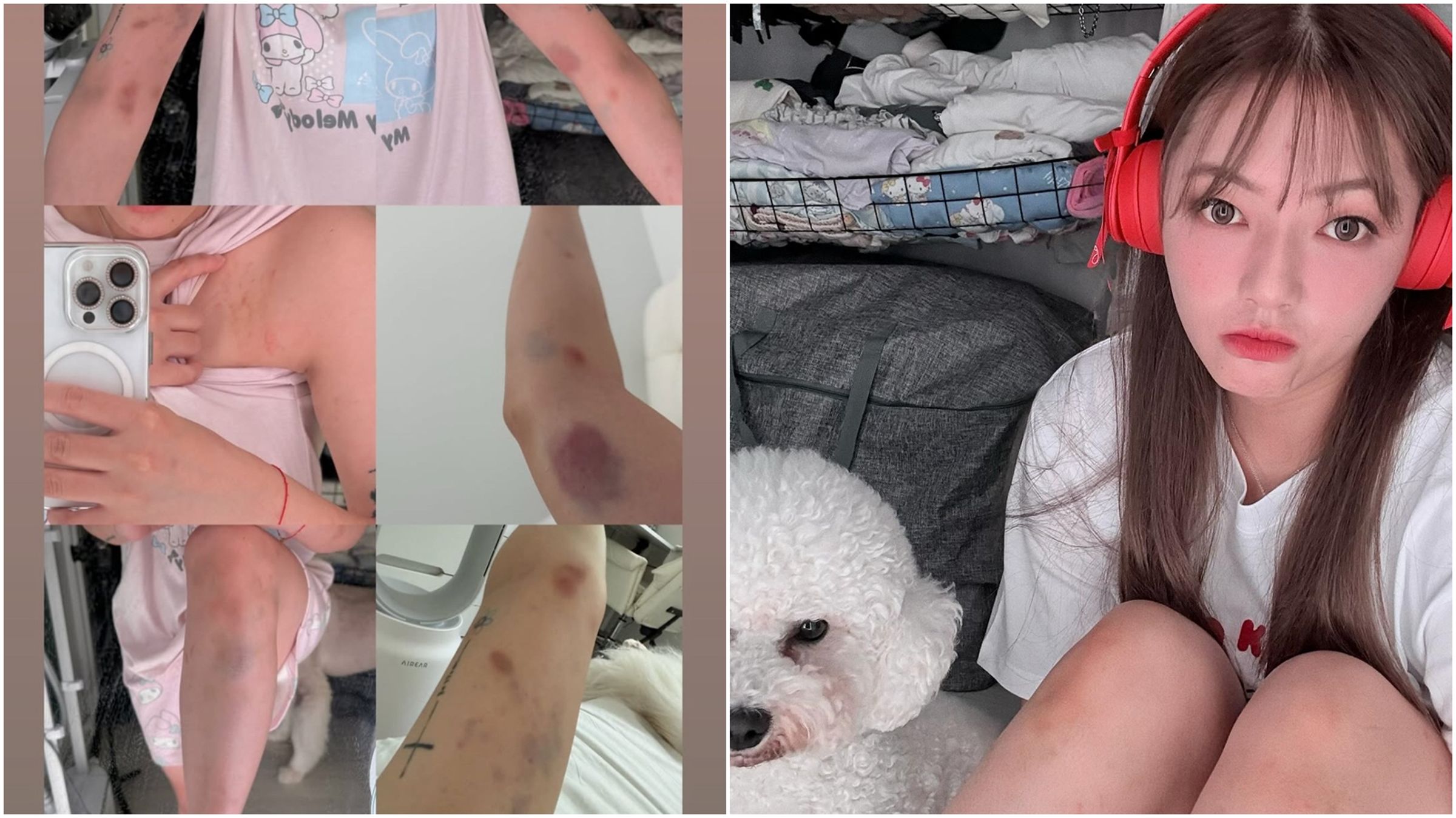 劉力穎因婉拒陌生男性過夜邀請就遭暴力毆打。(翻攝自Instagram@liying0731)