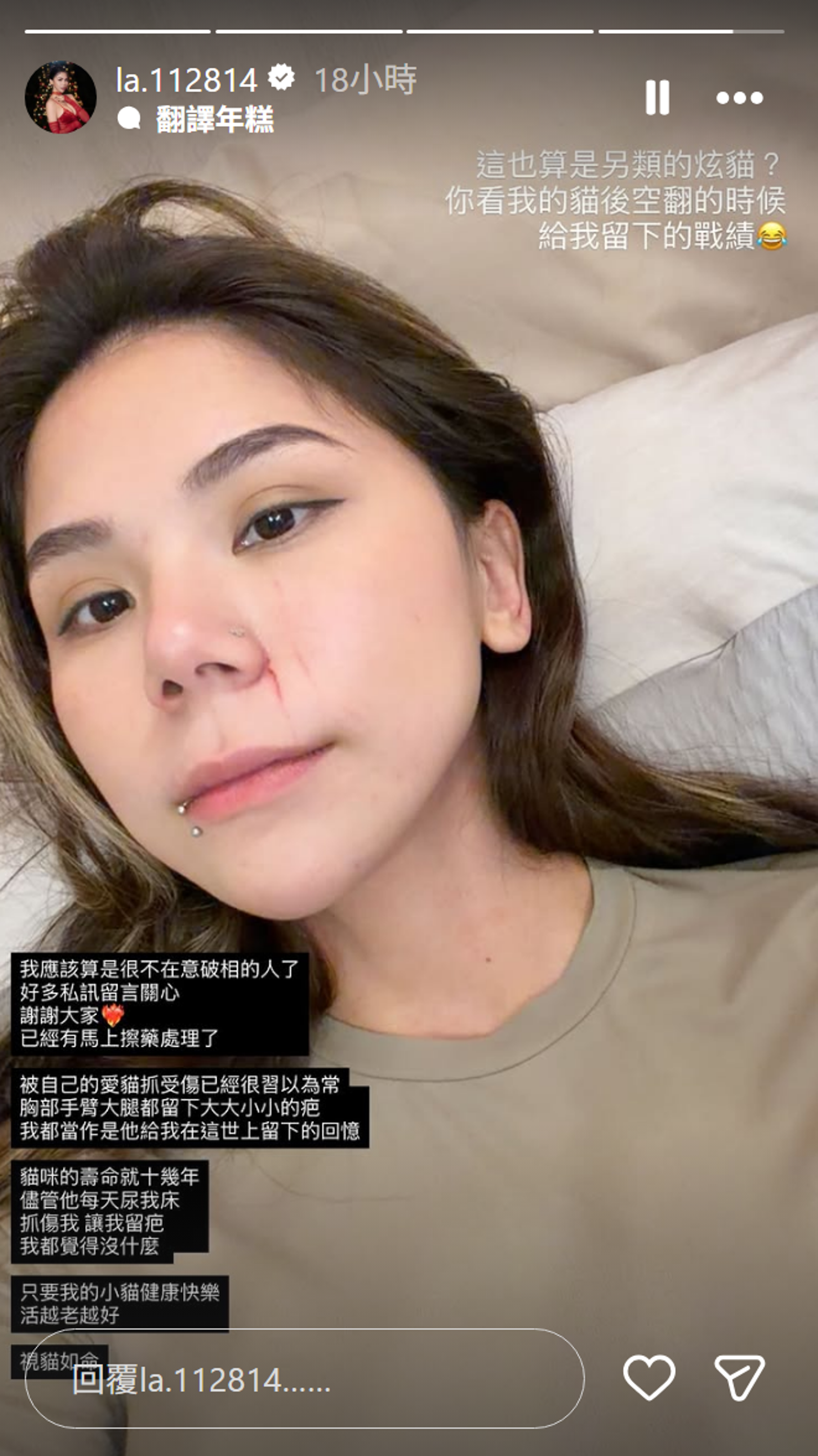 蕾菈破相要網友別擔心。（翻攝IG@la.112814）