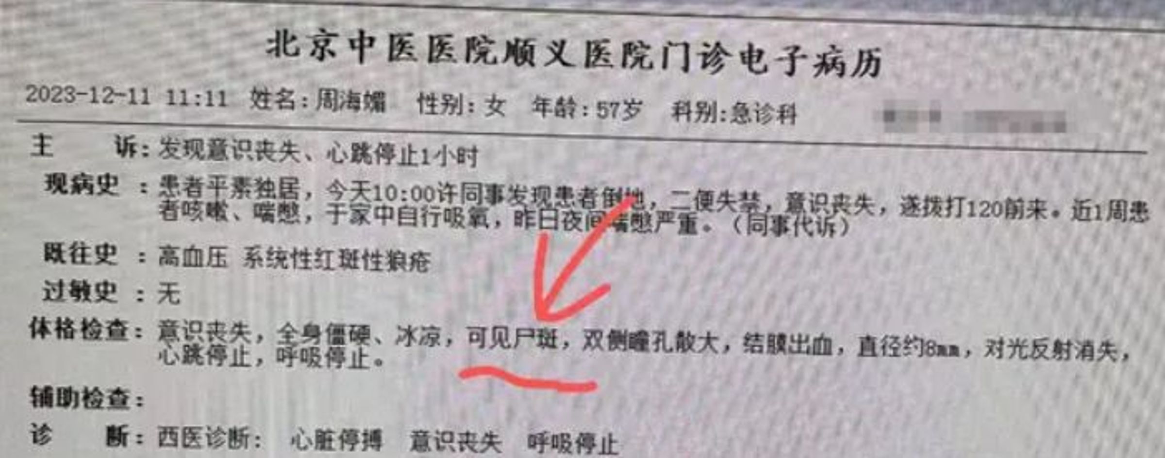 周海媚急診病例在網路流傳。（翻攝自微博）