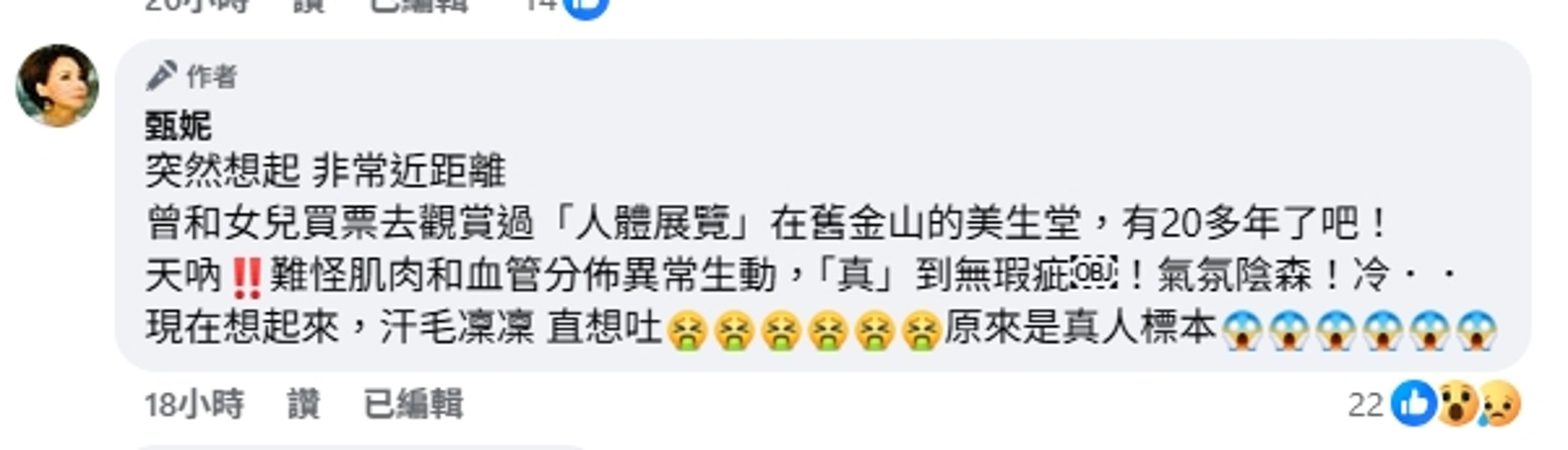 甄妮表示,過去曾和女兒買票近距離觀賞人體展,現在想起來發現疑似是「真人標本」。(翻攝自臉書)