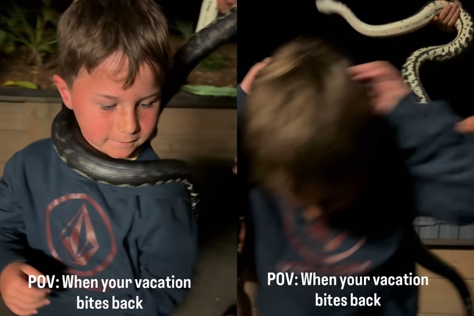 澳大利亞昆士蘭1名7歲男童克魯斯日前在動物園遭蛇咬頭受傷。（翻攝自salty_craft_family IG）