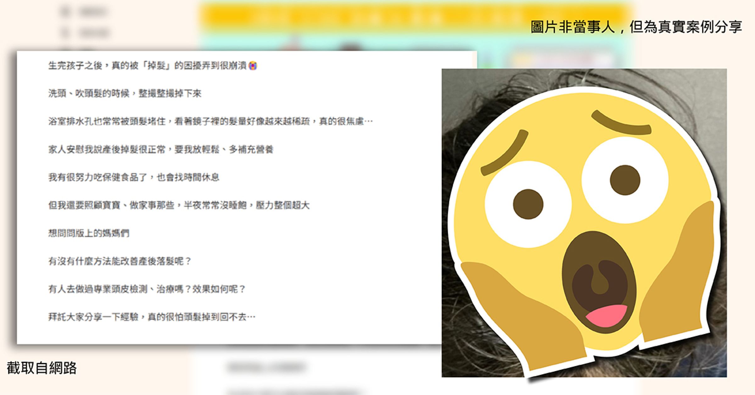 愛爾麗跨足生髮領域,攜手韓國Dr.Scalp團隊推動頭皮健檢與養護,透過科學化管理協助產後媽媽把握黃金修復期,重拾濃密髮量與自信。
