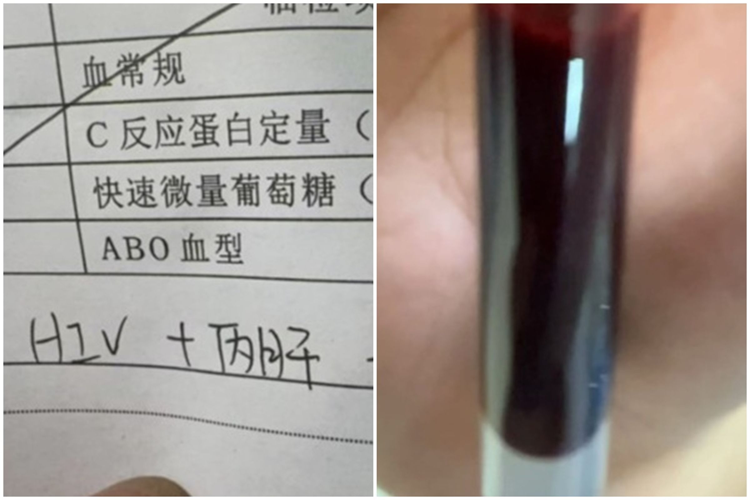 「熾陽」表示已赴醫院做性病檢查。(翻攝自微博)