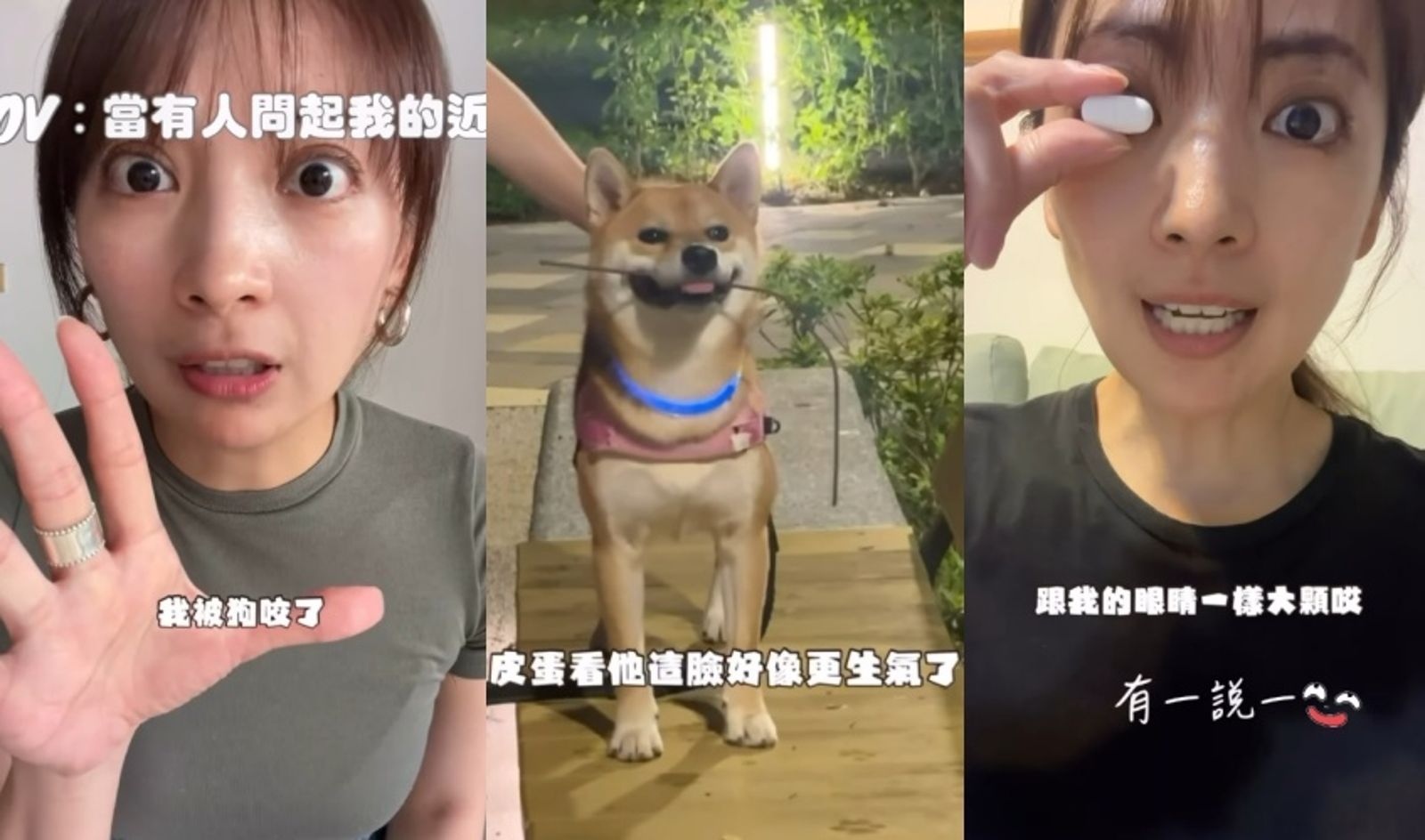 驚悚過程曝!阿喜肉身護愛犬慘遭狗咬「美腿留雙孔血印」 走路變掰咖...高EQ拍片揭近況