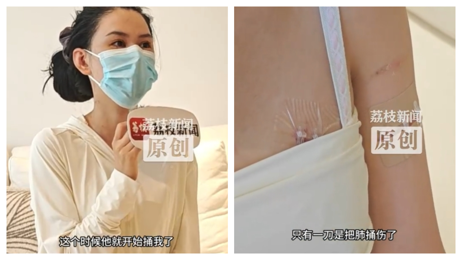 女子被捅了20多刀後，靠曾做過隆胸手術的假體躲過致命一擊。（翻攝自微薄@荔枝新聞）