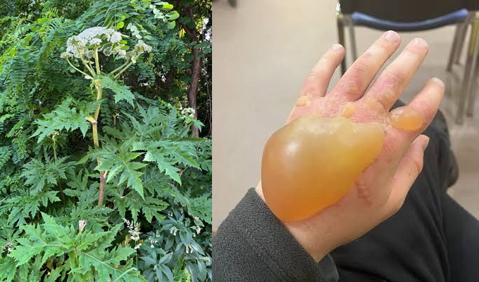 大豬草近期疑似在北海道札幌市多處現蹤,引發當地政府高度警戒。(翻攝自X)