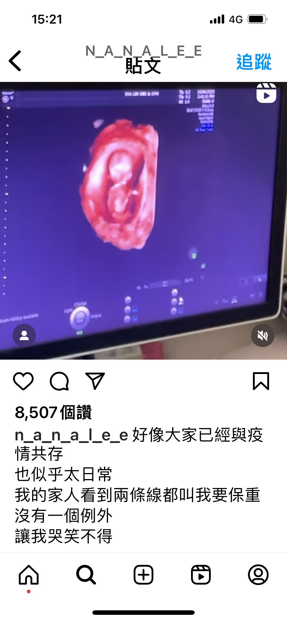 李千娜po出超音波圖宣告懷孕！（翻攝自李千娜IG）
