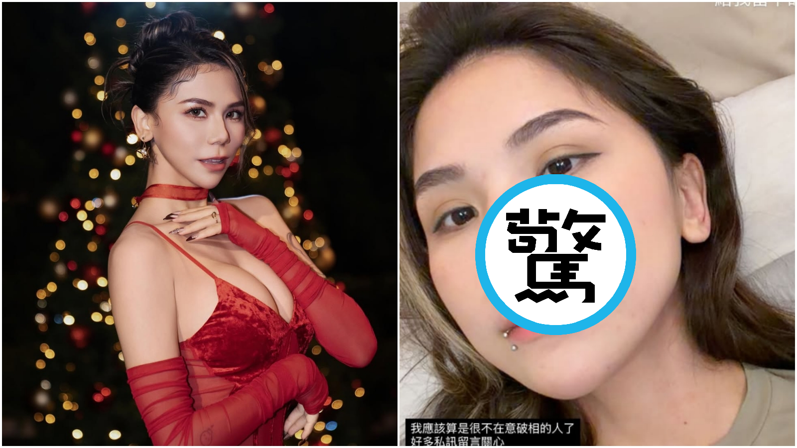 蕾菈(Lyla)臉蛋留下愛貓後空翻「戰績」。(翻攝IG@la.112814)