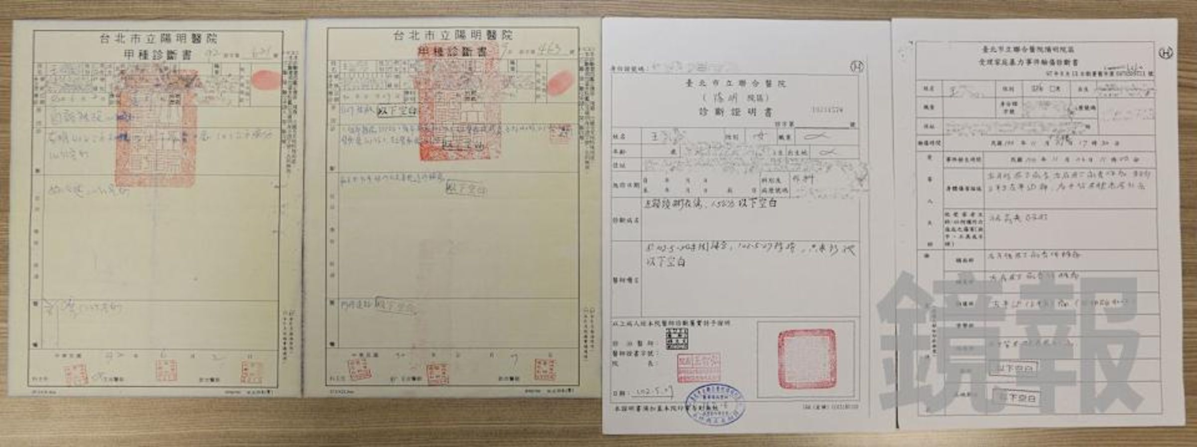 結縭24年的前妻王小姐出面控訴長期施加家庭暴力，並曝光4張包含臉部瘀青、深層撕裂傷縫合等驚悚驗傷單，指控張耕宇因教養問題與復婚話題多次失控動手。（王小姐提供）