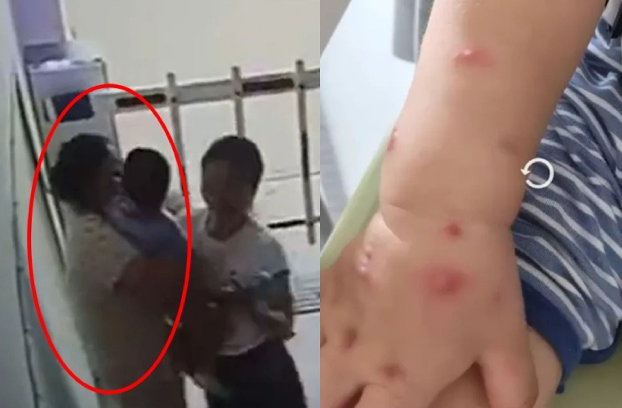 這不是恐怖片？大媽（紅圈處）孩子原本長水痘，然而在強吻鄰居嬰兒後竟痊癒，但鄰居嬰兒當晚卻高燒、爆水痘。（翻攝自微博）