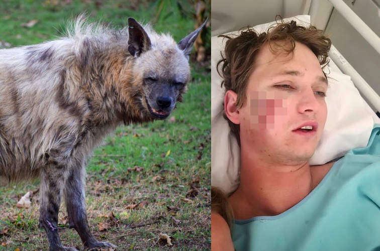 南非男子（右）露營遇鬣狗襲擊，險些被拖進森林吞食。（左為示意圖pexels／右翻攝自Colin Hohls）