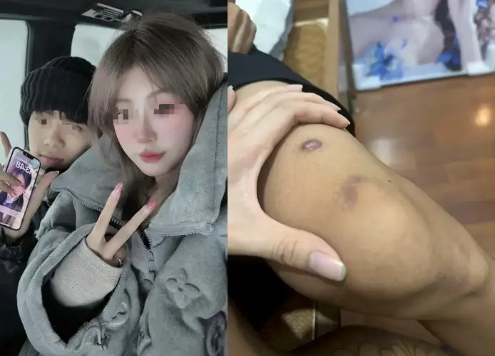 信錯初戀！廣東男被「10萬賣掉」，淪緬甸詐騙園區虐打失聰。（翻攝自微博）